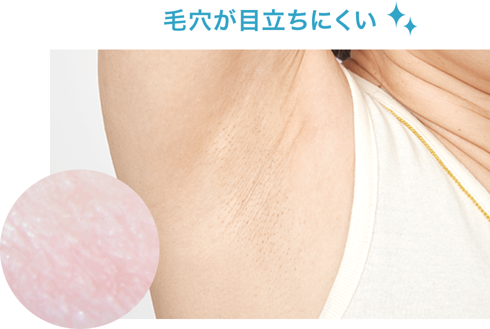 毛穴が目立ちにくい