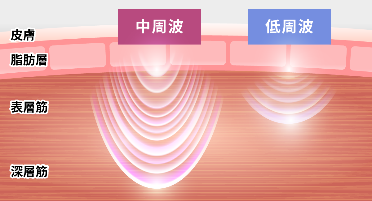 肌イメージ