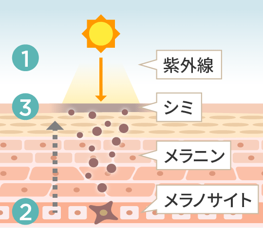 シミ・そばかすを防ぐ1