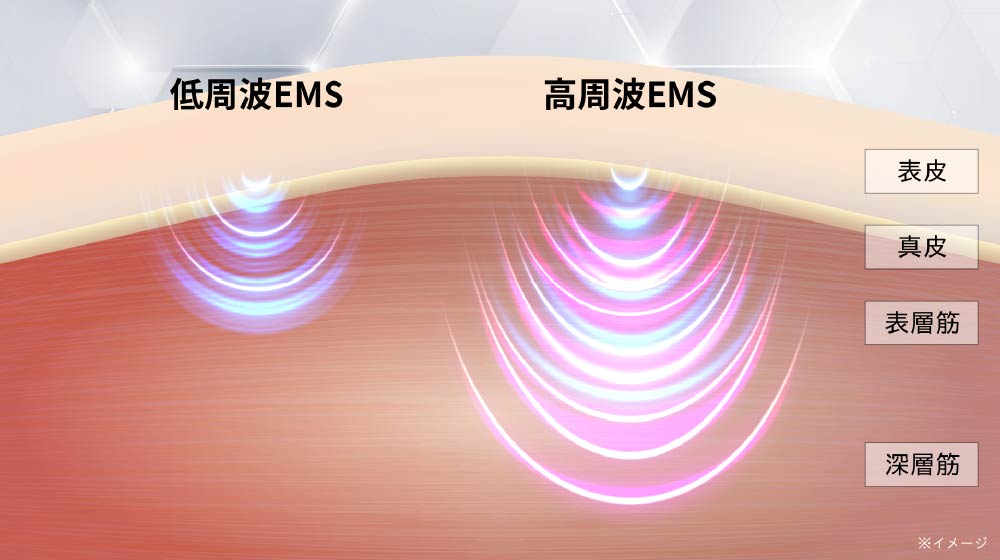 低周波EMS/高周波EMSイメージ"