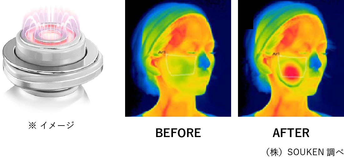 RF（ラジオ波）で温めながらケア BEFORE/AFTER