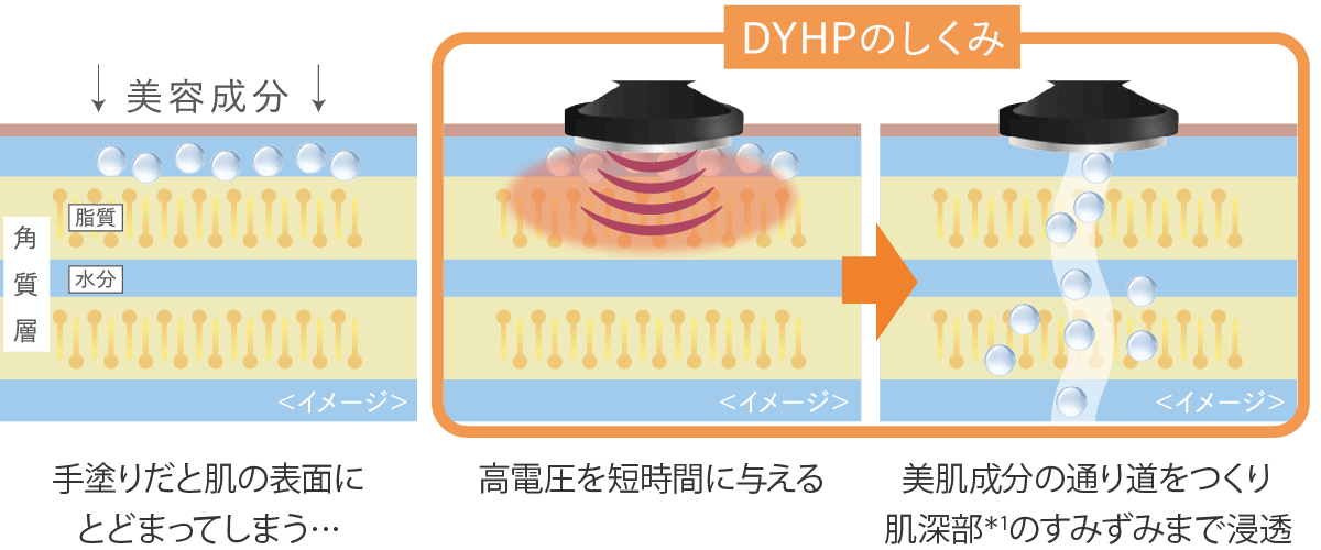 独自技術DYHP