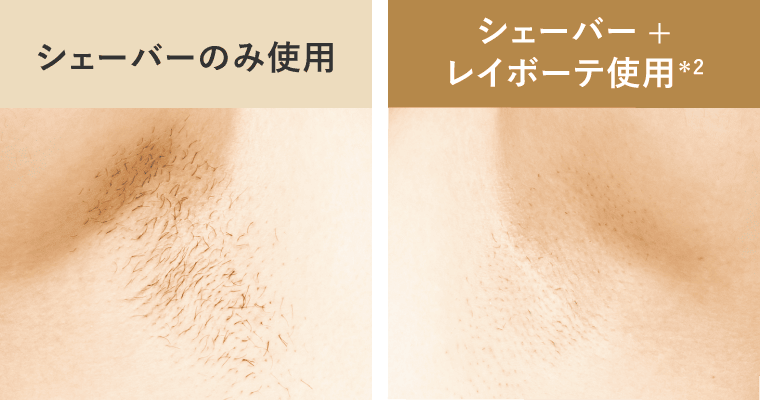 シェーバーのみ使用/シェーバー+レイボーテ使用