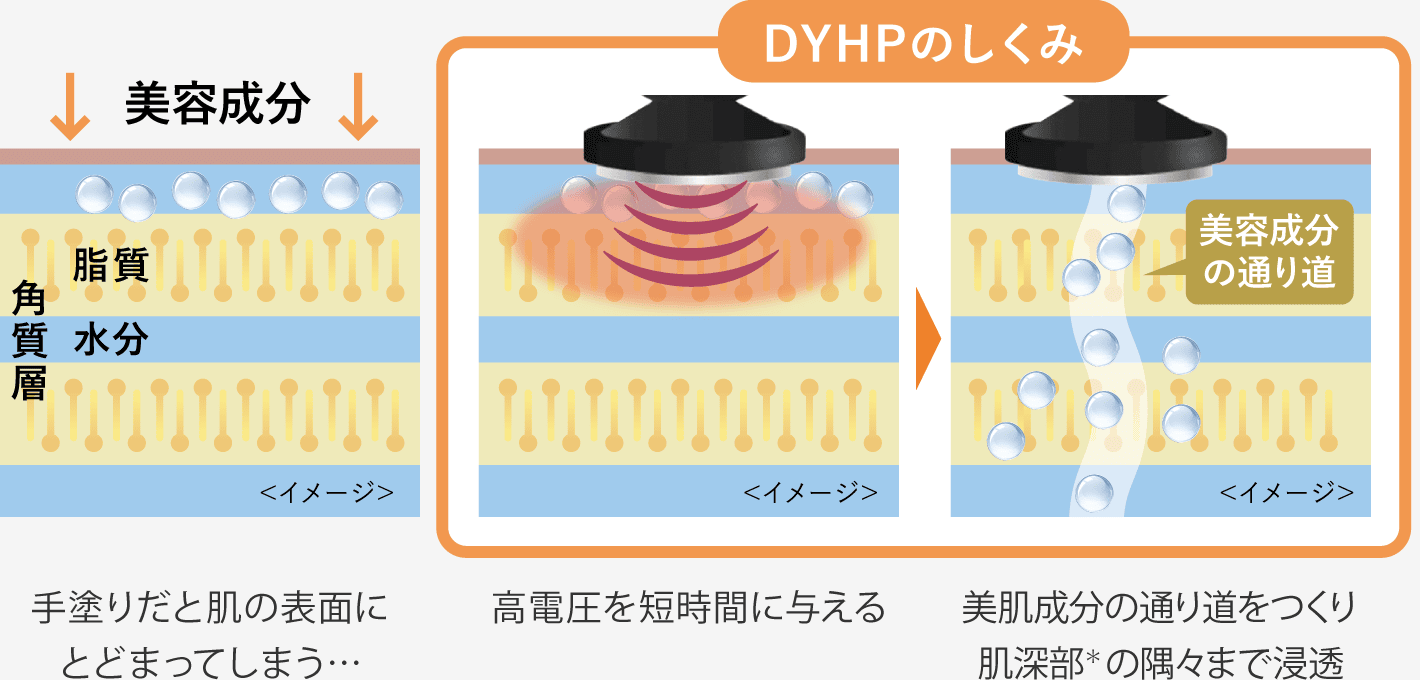 DYHPのしくみ