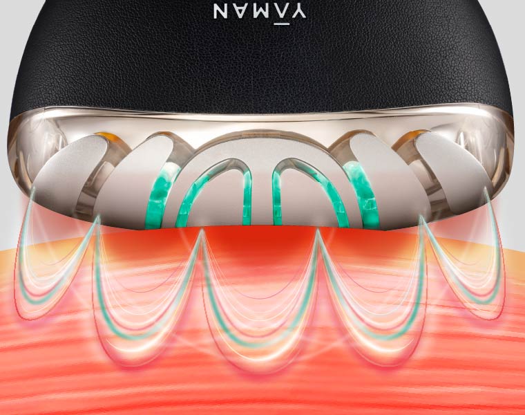 独自EMS波形が進化