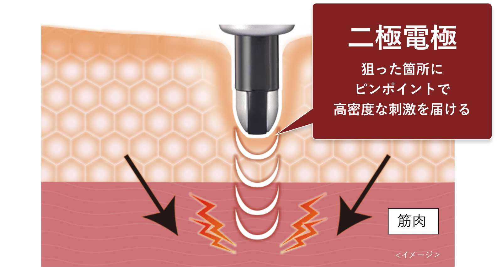 ニードルモードの刺激のイメージ図